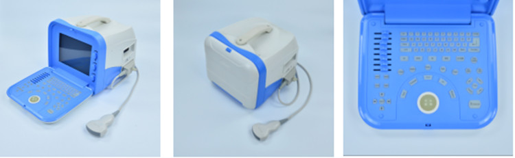 Digital Ultrasound Digital Ultrasound