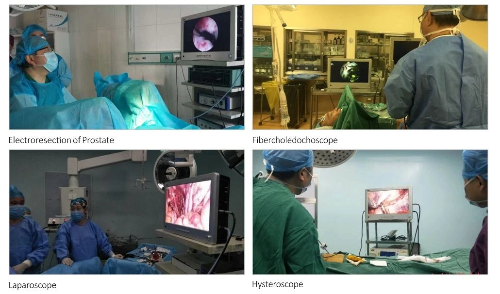 Laparoscope