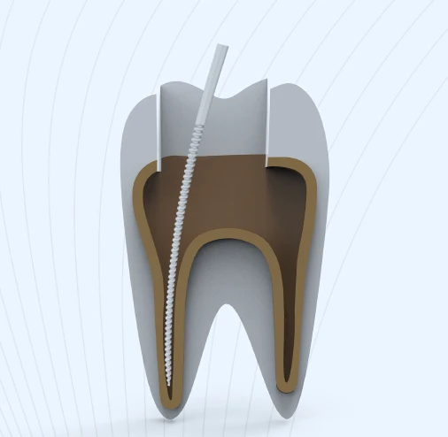 Teeth Cleaning Machine Teeth Cleaning Machine