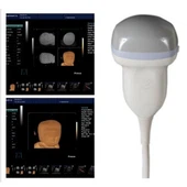 China Ultrasound Transducer 4D Ultrasound Transducer