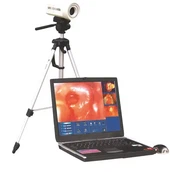 Sony Medical Hospital sérhæft stafrænt sjón-colposcope